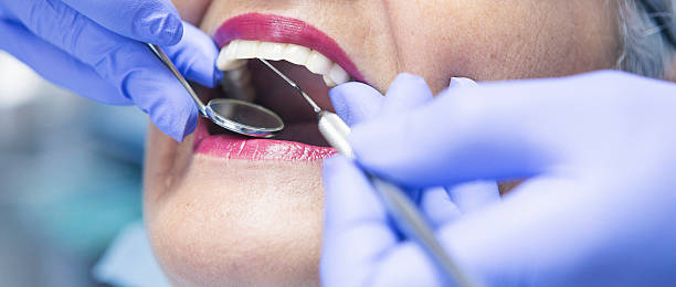 Best Emergency Dentist for Knocked-Out Tooth in Channahon, IL